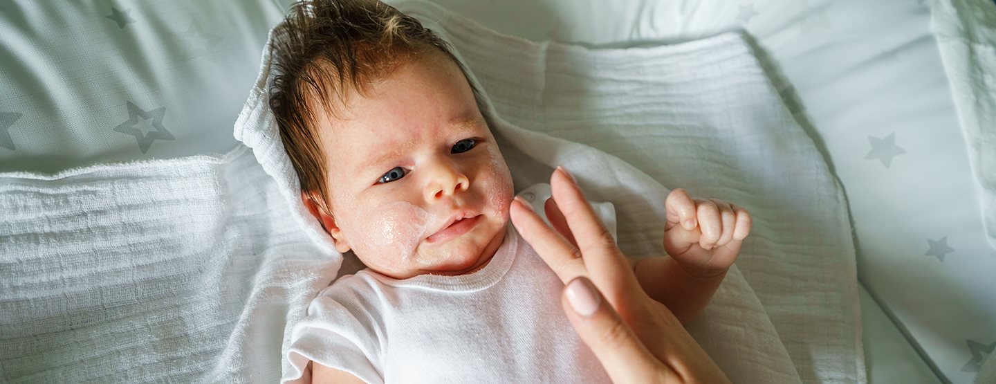 Neurodermatitida u miminek a dětí: Nejčastější otázky a odpovědi